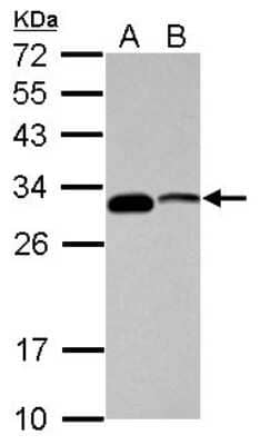 Western Blot: CENPP Antibody [NBP2-15859] - Sample (30 ug of whole cell lysate) A: K562 B: HL-60 12% SDS PAGE gel, diluted at 1:3000.