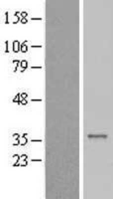 Western Blot: CENPP Overexpression Lysate (Adult Normal) [NBL1-09091] Left-Empty vector transfected control cell lysate (HEK293 cell lysate); Right -Over-expression Lysate for CENPP.