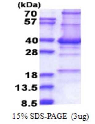 SDS-Page: CENPP Protein [NBP2-22767]