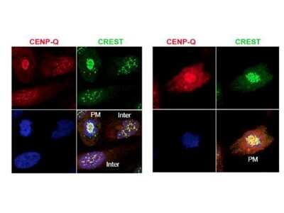 Immunocytochemistry/Immunofluorescence: CENPQ Antibody [NBP1-42740] - Analysis of endogenous CENP-Q in HeLa whole cell lysate. Primary antibody was used at 1:100 followed by secondary antibody diluted 1:150. Red punctate anti-CENP-Q signal colocalizes in overlay images with green punctate anti-CREST signals at the kinetochores (attached points of sister chromatids). Visible are colocalized CENP-Q and CREST signal at various stages of the cell cycle as indicated from interphase to the end of mitosis. Nuclei are counter stained with bisbenzimide.