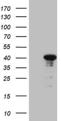 Western Blot: CENPQ Antibody (OTI1C5) - Azide and BSA Free [NBP2-71991] - Analysis of HEK293T cells were transfected with the pCMV6-ENTRY control (Left lane) or pCMV6-ENTRY CENPQ.