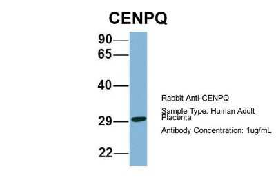 Western Blot: CENPQ Antibody [NBP1-55216] - Human Adult Placenta, Antibody Dilution: 1.0 ug/ml.