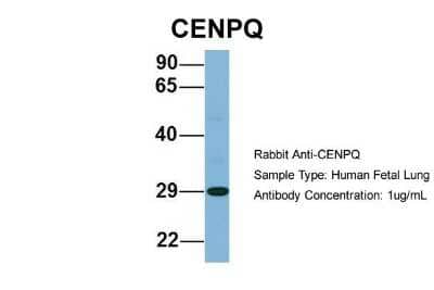 Western Blot: CENPQ Antibody [NBP1-55216] - Human Fetal Lung, Antibody Dilution: 1.0 ug/ml.