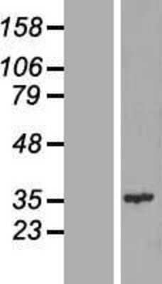 Western Blot: CENPQ Overexpression Lysate (Adult Normal) [NBL1-09092] Left-Empty vector transfected control cell lysate (HEK293 cell lysate); Right -Over-expression Lysate for CENPQ.