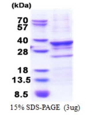 SDS-Page: CENPQ Protein [NBP2-22768]