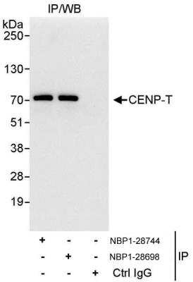 Immunoprecipitation: CENPT Antibody [NBP1-28698] - Samples: Whole cell lysate (1 mg for IP, 20% of IP loaded) from HeLa cells.   Antibodies: Affinity purified rabbit anti-CENP-T antibody NBP1-28698 used for IP at 10 ug/mg lysate.  CENP-T was also immunoprecipitated by rabbit anti-CENP-T antibody NBP1-28744, which recognizes an upstream epitope.  For blotting immunoprecipitated CENP-T, NBP1-28744 was used at 1 ug/ml.  Detection: Chemiluminescence with an exposure time of 3 seconds.