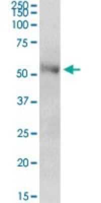 Western Blot CENPT Antibody - Azide and BSA Free