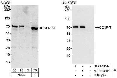 Western Blot: CENPT Antibody [NBP1-28744] - Samples: Whole cell lysate from HeLa (5, 15 and 50 ug for WB; 1 mg for IP, 20% of IP loaded) and 293T (T; 50 ug) cells.   Antibodies: Affinity purified rabbit anti-CENP-T antibody NBP1-28744 used for WB at 0.1 ug/ml (A) and 1 ug/ml (B) and used for IP at 10 ug/mg lysate.  CENP-T was also immunoprecipitated by rabbit anti-CENP-T antibody NBP1-28698, which recognizes a downstream epitope.  Detection: Chemiluminescence with exposure times of 3 minutes (A) and 3 seconds (B).