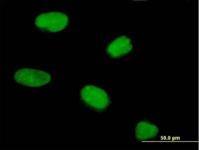 Immunocytochemistry/Immunofluorescence: CENPV Antibody [H00201161-B01P] - Analysis of purified antibody to PRR6 on HeLa cell. (antibody concentration 10 ug/ml)