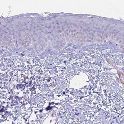 Immunohistochemistry-Paraffin: CENPV Antibody [NBP1-84545] - Staining of human skin shows low expression as expected.