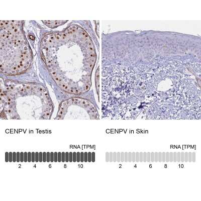 Immunohistochemistry-Paraffin: CENPV Antibody [NBP1-84545] - Staining in human testis and skin tissues using anti-CENPV antibody. Corresponding CENPV RNA-seq data are presented for the same tissues.