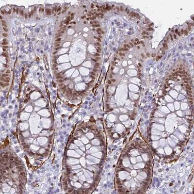 Immunohistochemistry-Paraffin: CENPV Antibody [NBP1-84545] - Staining of human gastrointestinal shows moderate to strong nuclear positivity in glandular cells.