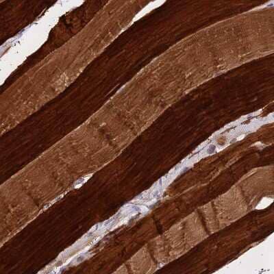 Immunohistochemistry-Paraffin: CENPV Antibody [NBP1-84545] - Staining of human skeletal muscle shows moderate to strong cytoplasmic positivity in myocytes.