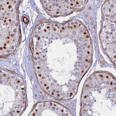 <b>Orthogonal Strategies Validation. </b>Immunohistochemistry-Paraffin: CENPV Antibody [NBP1-84545] - Staining of human testis shows moderate to strong nuclear positivity in cells in seminiferous ducts.