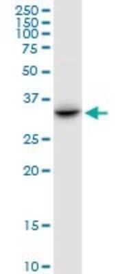 Western Blot: CENPV Antibody [H00201161-B01P] - Analysis of CENPV expression in HeLa.