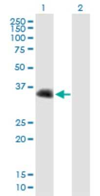 Western Blot: CENPV Antibody [H00201161-B01P] - Analysis of CENPV expression in transfected 293T cell line by CENPV polyclonal antibody.  Lane 1: PRR6 transfected lysate(30.25 KDa). Lane 2: Non-transfected lysate.