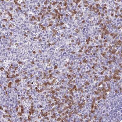 Immunohistochemistry CEP120 Antibody - BSA Free
