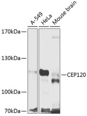 Western Blot: CEP120 Antibody [NBP2-92822] - Analysis of extracts of various cell lines, using CEP120 at 1:1000 dilution.Secondary antibody: HRP Goat Anti-Rabbit IgG (H+L) at 1:10000 dilution.Lysates/proteins: 25ug per lane.Blocking buffer: 3% nonfat dry milk in TBST.Detection: ECL Basic Kit .Exposure time: 90s.