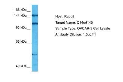Western Blot: CEP128 Antibody [NBP2-87170] - Host: Rabbit. Target Name: C14ORF145. Sample Tissue: Human OVCAR-3 Whole Cell lysates. Antibody Dilution: 1ug/ml