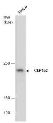 Western Blot: CEP152 Antibody (1285) [NBP2-43722] - Analysis of Whole cell extracts (30 ug) was separated by 5 % SDS-PAGE, and blotted with CEP152 antibody [1285] diluted by 1:500, and developed with Trident Sharp-ECL .