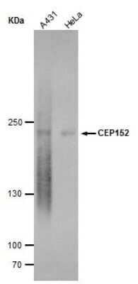 Western Blot: CEP152 Antibody (1315) [NBP2-43721] - Analysis of various whole cell extracts (30 ug) were separated by 5 % SDS-PAGE, and blotted with CEP152 antibody [1315] diluted by 1:500, and developed with Trident Sharp-ECL .