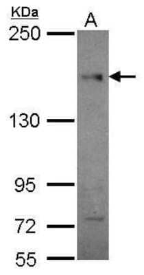 Western Blot: CEP164 Antibody (13) [NBP2-43631] - Analysis of 30 ug whole cell lysate. A: HeLa 5% SDS PAGE diluted at 1:1000.