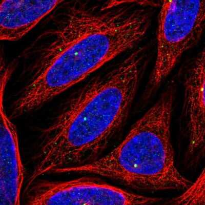 Immunocytochemistry/Immunofluorescence: CEP164 Antibody [NBP2-68776] - Staining of human cell line SiHa shows localization to centrosome & vesicles.