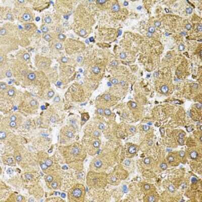 Immunohistochemistry-Paraffin: CEP164 Antibody [NBP2-92844] - Paraffin-embedded human liver damage using CEP164 .