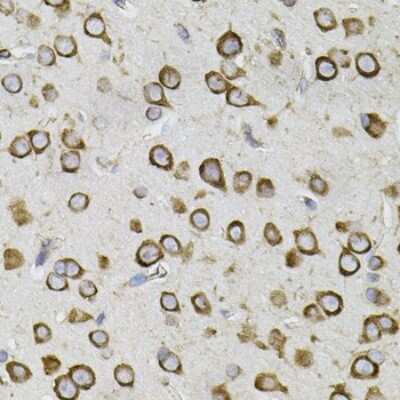 Immunohistochemistry-Paraffin: CEP164 Antibody [NBP2-92844] - Paraffin-embedded mouse brain using CEP164 .