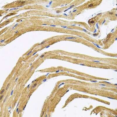 Immunohistochemistry-Paraffin: CEP164 Antibody [NBP2-92844] - Paraffin-embedded rat heart using CEP164 .