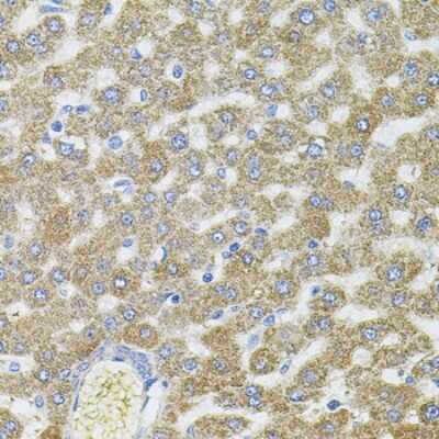 Immunohistochemistry-Paraffin: CEP164 Antibody [NBP2-92844] - Paraffin-embedded rat liver using CEP164 .