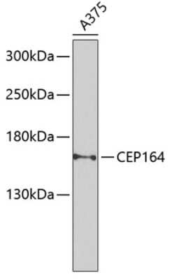 Western Blot: CEP164 Antibody [NBP2-92844] - Analysis of extracts of A-375 cells, using CEP164 at 1:1000 dilution.Secondary antibody: HRP Goat Anti-Rabbit IgG (H+L) at 1:10000 dilution.Lysates/proteins: 25ug per lane.Blocking buffer: 3% nonfat dry milk in TBST.Detection: ECL Basic Kit .Exposure time