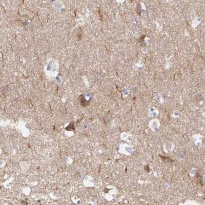 Immunohistochemistry-Paraffin: CEP170B Antibody [NBP2-31992] - Staining of human cerebral cortex shows moderate cytoplasmic positivity in neurons.