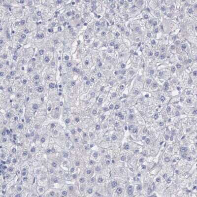 Immunohistochemistry-Paraffin: CEP170B Antibody [NBP2-31992] - Staining of human liver shows no cytoplasmic positivity in hepatocytes as expected.