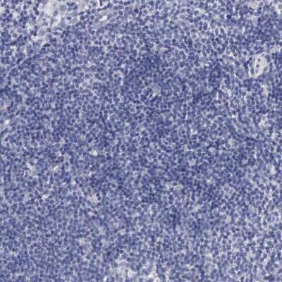 Immunohistochemistry-Paraffin: CEP170B Antibody [NBP2-31992] - Staining of human lymph node shows no positivity in non-germinal center cells as expected.