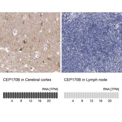 Immunohistochemistry-Paraffin: CEP170B Antibody [NBP2-31992] - Analysis in human cerebral cortex and lymph node tissues using NBP2-31992 antibody. Corresponding CEP170B RNA-seq data are presented for the same tissues.