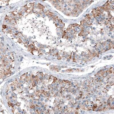 Immunohistochemistry-Paraffin: CEP192 Antibody [NBP1-84634] - Staining of human testis shows moderate granular cytoplasmic positivity in cells in seminiferous ducts.