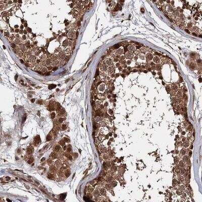 Immunohistochemistry-Paraffin: CEP192 Antibody [NBP1-84635] - Staining of human testis shows strong nuclear and cytoplasmic positivity.