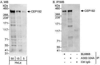 Western Blot: CEP192 Antibody [NBP1-28718] - Detection of Human CEP192 by Western Blot and Immunoprecipitation. Samples: Whole cell lysate (5, 15 and 50 mcg for WB; 1 mg for IP, 20% of IP loaded) from HeLa cells.   Antibodies: Affinity purified rabbit anti-CEP192 antibody NBP1-28718 used for WB at 0.4 mcg/ml (A) and 1 mcg/ml (B) and used for IP at 10 mcg/mg lysate.  CEP192 was also immunoprecipitated by rabbit anti-CEP192 antibody BL6868, which recognizes an upstream epitope.  For blotting immunoprecipitated CEP192, the ReliaBLOT®  Reagents and Procedures were used.  Detection: Chemiluminescence with exposure times of 3 minutes (A) and 30 seconds (B).