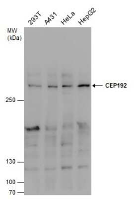 Western Blot: CEP192 Antibody [NBP3-13048] - CEP192 antibody detects CEP192 protein by western blot analysis. Various whole cell extracts (30 ug) were separated by 5% SDS-PAGE, and the membrane was blotted with CEP192 antibody (NBP3-13048) diluted at 1:1000.