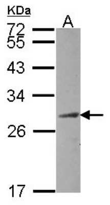 Western Blot: CEP27 Antibody [NBP2-15861] - Sample (30 ug of whole cell lysate) A: Raji 12% SDS PAGE gel, diluted at 1:1000.