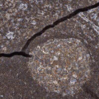 Immunohistochemistry: CEP295NL Antibody [NBP2-47511] - Staining of human tonsil shows moderate positivity in reaction center cells while cells outside the reaction center were strongly positive.