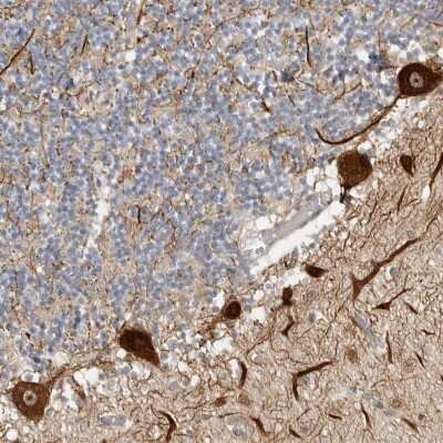 Immunohistochemistry: CEP295NL Antibody [NBP2-47512] - Staining of human cerebellum shows strong dot like nucleolar and cytoplasmic positivity in purkinje cells.