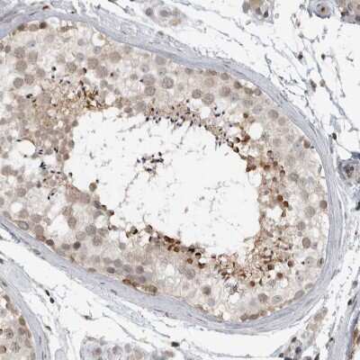 Immunohistochemistry-Paraffin CEP295NL Antibody - BSA Free