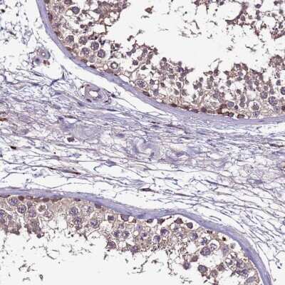 Immunohistochemistry-Paraffin CEP55 Antibody