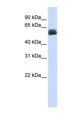 Western Blot: CEP55 Antibody [NBP1-53039] - Human Lung lysate, concentration 0.2-1 ug/ml.
