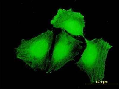 Immunocytochemistry/Immunofluorescence: CEP57 Antibody [H00009702-B01P] - Analysis of purified antibody to CEP57 on HeLa cell. (antibody concentration 10 ug/ml)