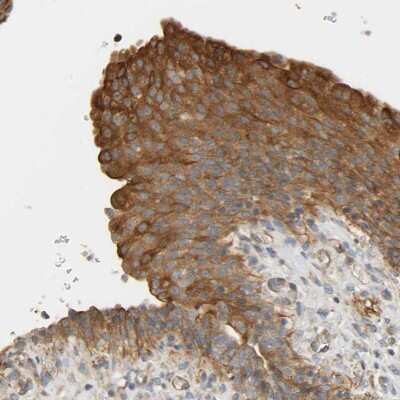 Immunohistochemistry-Paraffin CEP57 Antibody