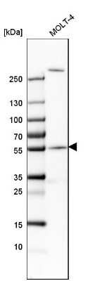 Western Blot CEP57 Antibody