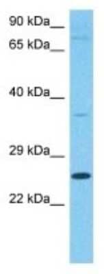 Western Blot: CEP57 Antibody [NBP3-10691] - Western blot analysis of CEP57 in Human Fetal Liver. Antibody dilution at 1 ug/mL